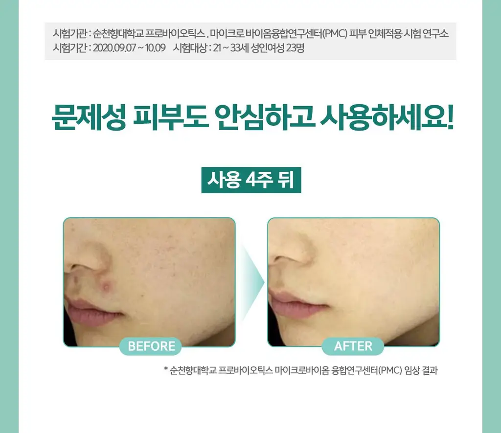 [민감성/여드름성피부적합] 테라비코스 엔자임 워싱 파우더 40g 상세페이지 31